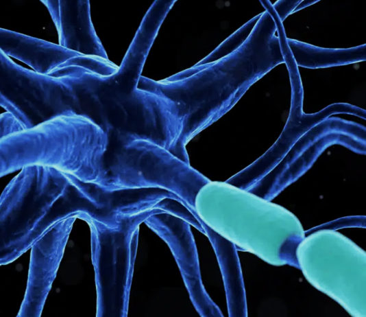 AC Immune erhält FDA Fast Track Designation für Alzheimer-Impfstoff