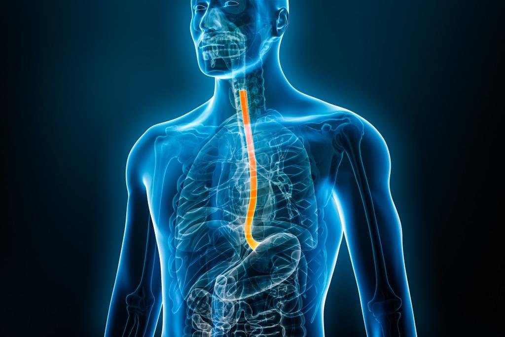 EsoCap meldet positive Topline-Ergebnisse der ACESO-Phase-II-Studie ESO-101 bei eosinophiler Ösophagitis