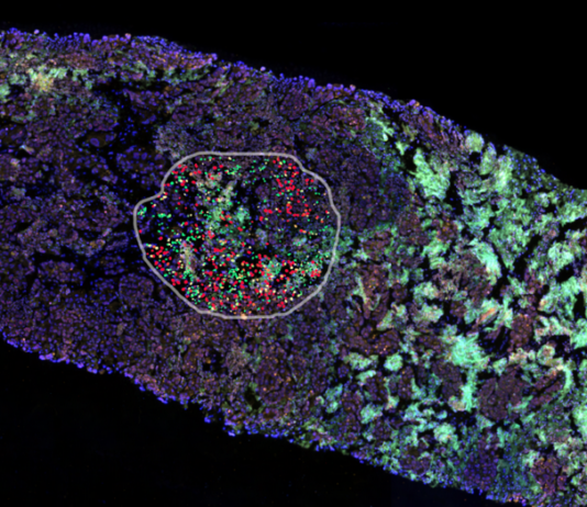 Case Study Katana Labs: Präzise gegen die Krebsdiagnostikkrise Illustration: © Katana Labs