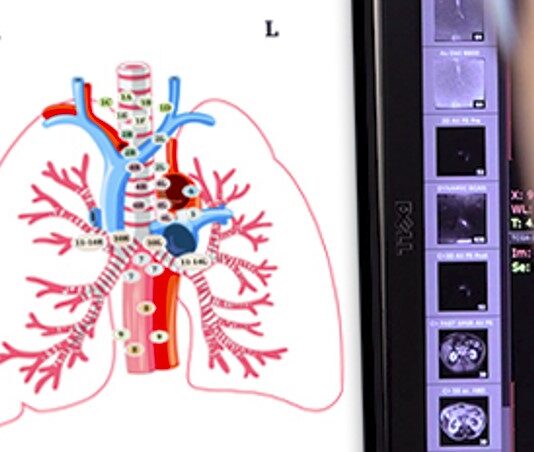 23 Millionen Euro für Smart Reporting Smart Reporting ist einer der führenden Technologieanbieter im Bereich der sprachgesteuerten, medizinischen Befundung. Copyright: Smart Reporting GmbH