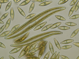 Symbolbild. Bewegliche Diatomeen der Gattungen Gyrosigma und Navicula. Mit KI erstellt.