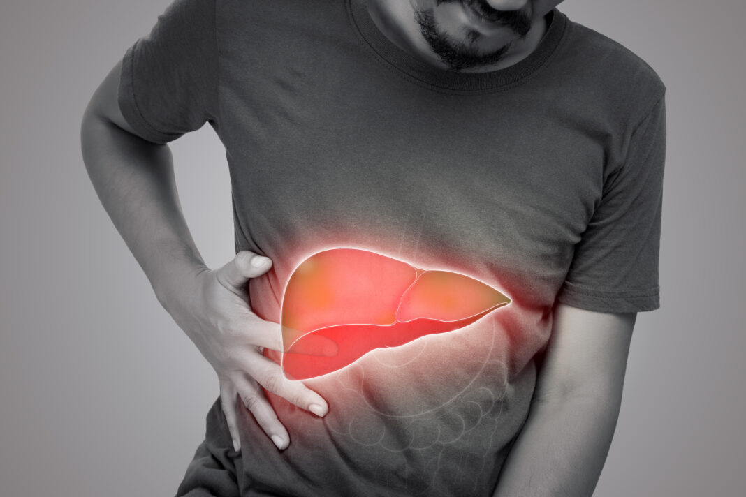 Symbolbild. The illustration of liver is on the man's body against gray background. A men with hepatitis and fatty liver problem. Copyright: eddows - stock.adobe.com