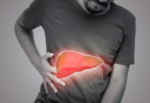Symbolbild. The illustration of liver is on the man's body against gray background. A men with hepatitis and fatty liver problem. Copyright: eddows - stock.adobe.com