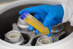Nahaufnahme einer ELAREM™ Perform Tube. © PL BioScience GmbH