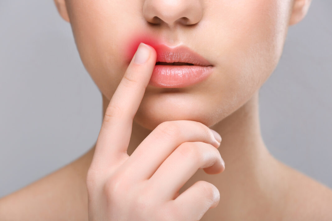 Symbolbild. "Woman touching lips". Copyright: Africa Studio - stock.adobe.com