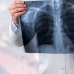 BioNTech punktet mit Lungenkrebsdaten – reicht das für einen Kursimpuls? Symbolbild "Lungenkrebs". Cancer. Copyright: BillionPhotos.com - stock.adobe.com