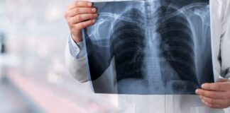 Symbolbild "Lungenkrebs". Cancer. Copyright: BillionPhotos.com - stock.adobe.com