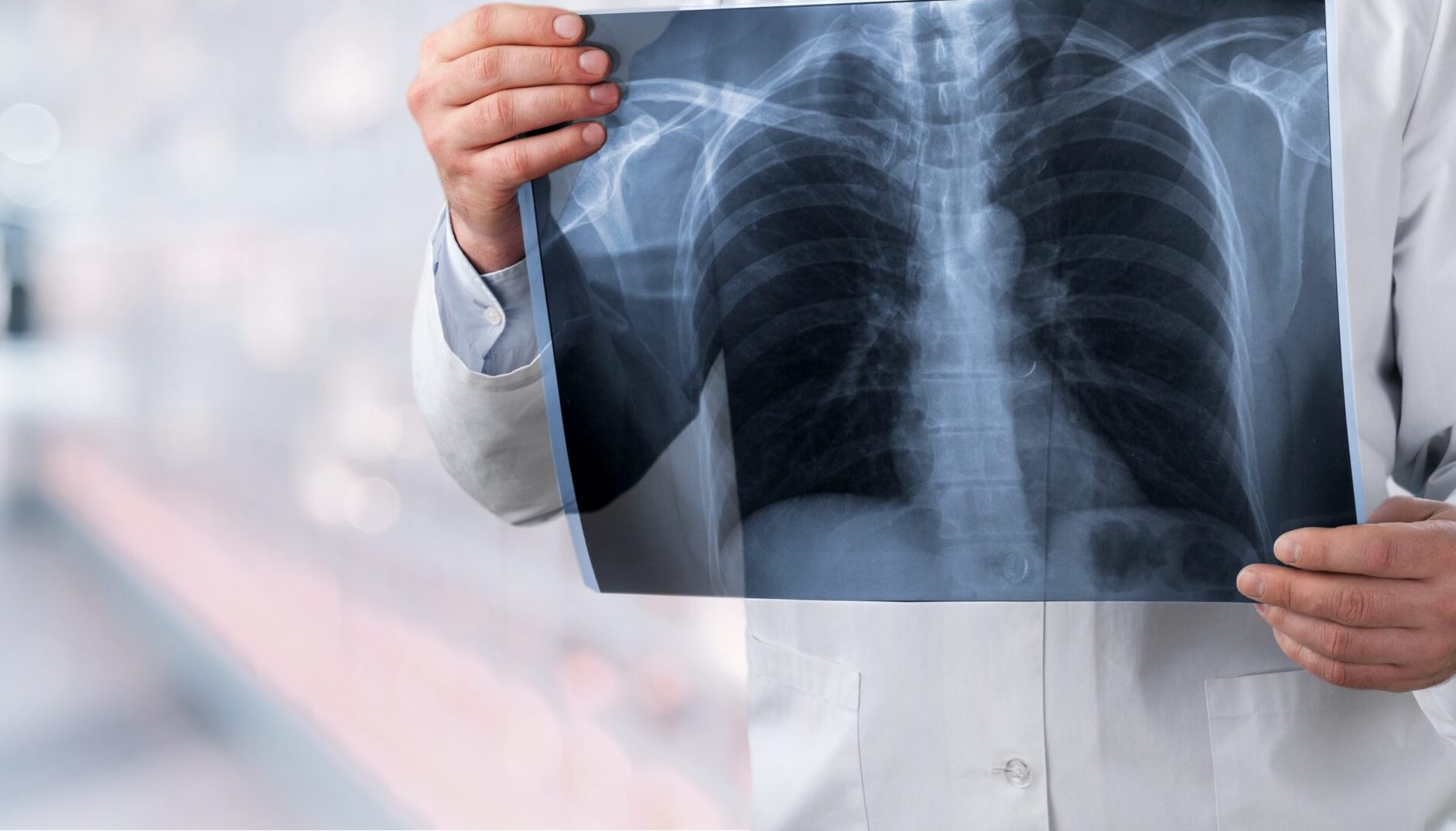 BioNTech-punktet-mit-Lungenkrebsdaten-reicht-das-f-r-einen-Kursimpuls-