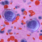 Symbolbild. Acute myeloid leukemia (AML) cells in blood flow - isometric view 3d, Copoyright LASZLO - stock.adobe.com