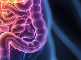 Abivax nutzt Kursrally für 600-Mio.-USD-Kapitalerhöhung Symbolbild "Colitis Ulcerosa". Copyright: feng - stock.adobe.com